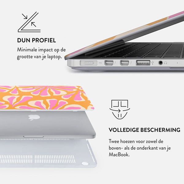 Burga Hardshell Cover MacBook Pro 13 inch (2020 / 2022) - A2289 / A2251 / A2338 - Aloha